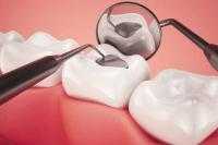Otturazione denti Tolentino provincia Macerata